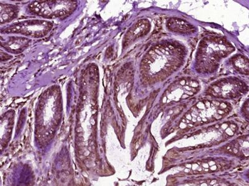 DBNDD1 Polyclonal Antibody