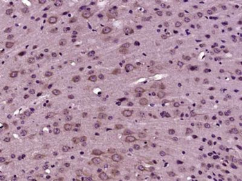 CTU2 Polyclonal Antibody
