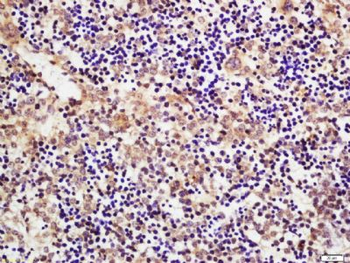 CSDE1 Polyclonal Antibody
