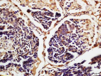 CSDE1 Polyclonal Antibody