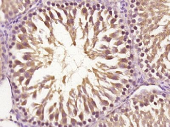 CRYGB Polyclonal Antibody