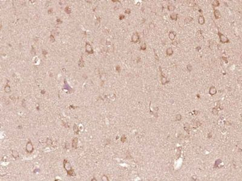 CRB1 Polyclonal Antibody
