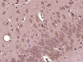 CPEB2 Polyclonal Antibody