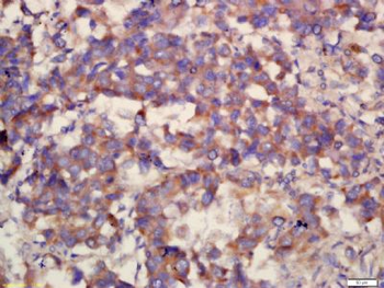 COX6B2 Polyclonal Antibody