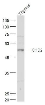 CHD2 Polyclonal Antibody