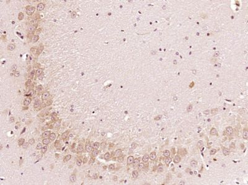 C19orf61 Polyclonal Antibody