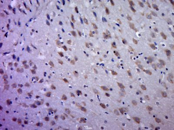 KXD1 Polyclonal Antibody
