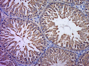 KXD1 Polyclonal Antibody