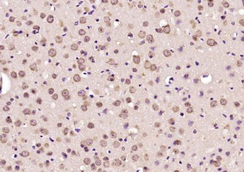 MRP63 Polyclonal Antibody