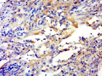 C1orf158 Polyclonal Antibody
