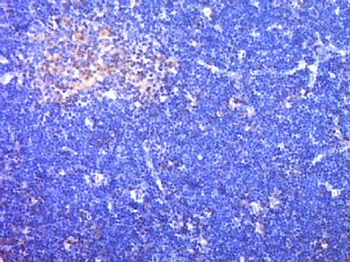 SKAP55 Polyclonal Antibody