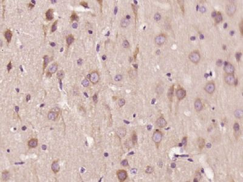 WDR91 Polyclonal Antibody