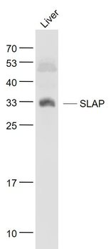 SLAP Polyclonal Antibody