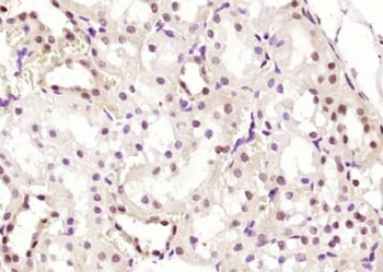 HESX1 Polyclonal Antibody