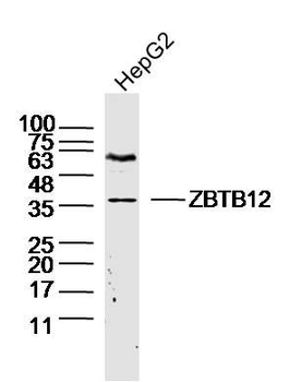 GPR31 Polyclonal Antibody
