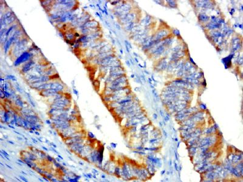 GPR31 Polyclonal Antibody