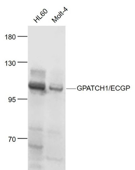 GPATCH1/ECGP Polyclonal Antibody