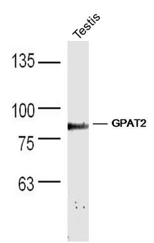 GPAT2 Polyclonal Antibody