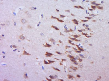 GOLT1A Polyclonal Antibody