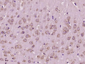 Glutathione Transferase zeta 1 Polyclonal Antibody