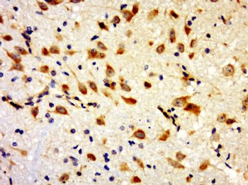GLT1D1 Polyclonal Antibody