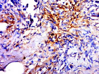 GLT1D1 Polyclonal Antibody