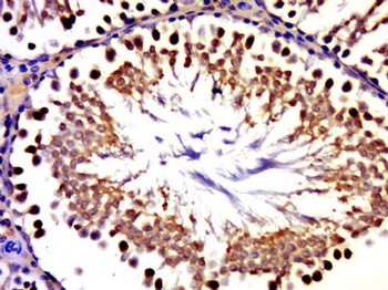 GLE1 Polyclonal Antibody