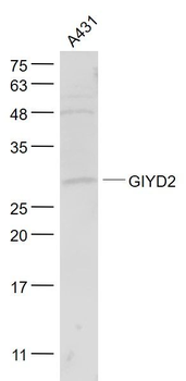 GIYD2 Polyclonal Antibody