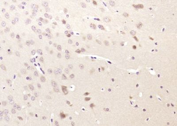 GARNL1 Polyclonal Antibody