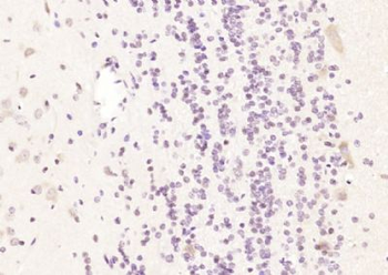 GALM Polyclonal Antibody