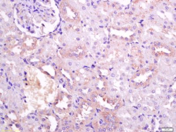 FHOD3 Polyclonal Antibody