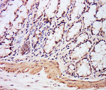EXOSC7 Polyclonal Antibody