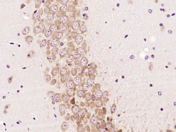 EXOC2 Polyclonal Antibody