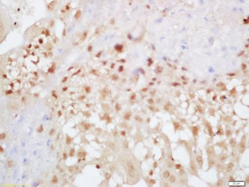 EXOC2 Polyclonal Antibody