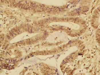 FABP12 Polyclonal Antibody