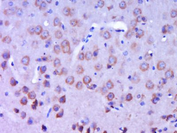 CSPS/MPST Polyclonal Antibody