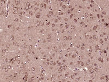 STIM2 Polyclonal Antibody