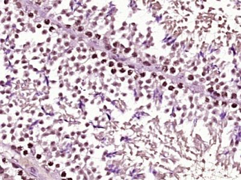 ZNF182 Polyclonal Antibody
