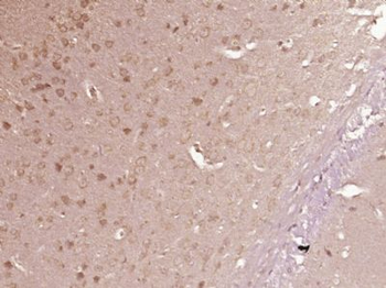 PLCD1/NDNC3 Polyclonal Antibody