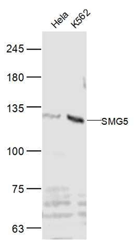 SMG5 Polyclonal Antibody