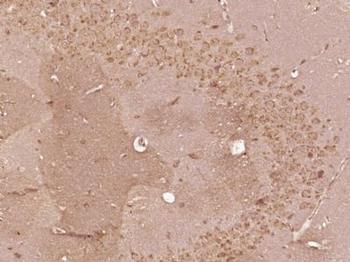 SMG5 Polyclonal Antibody