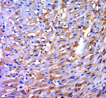 PDLIM2 Polyclonal Antibody