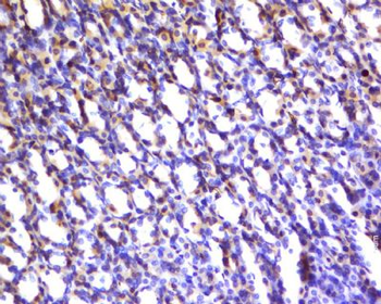 Acidic Calponin Polyclonal Antibody