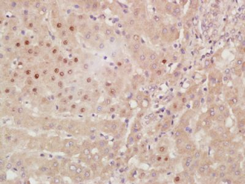 HES3 Polyclonal Antibody