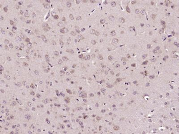 HES2 Polyclonal Antibody