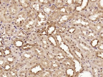 OSR1 + OSR2 Polyclonal Antibody