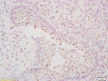 OSR1 + OSR2 Polyclonal Antibody