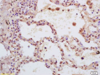 ZFX Polyclonal Antibody