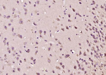 JLP/MAX binding protein Polyclonal Antibody