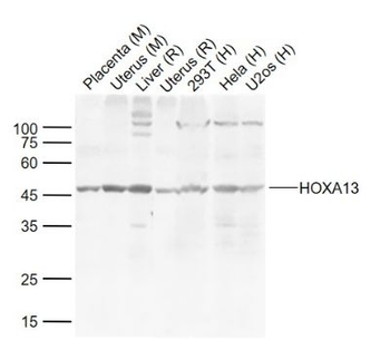 HOXA13 Polyclonal Antibody